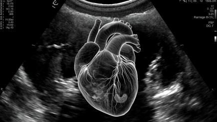 Ultrazvuk srca